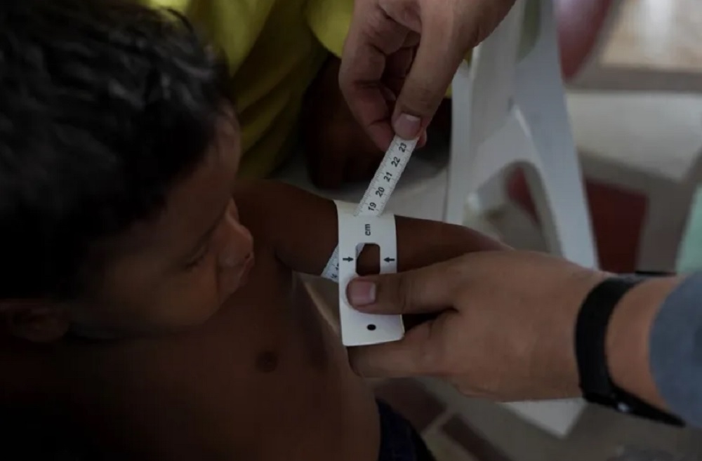 niños del estado Bolívar padecen desnutrición - según ONG - elsiglo.com.ve